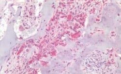 Osteocalcin Antibody, Novus Biologicals 50 &mu;g | Buy Online | Novus Biologicals | Fisher Scientific